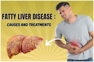 Fatty Liver Disease NAFLD illustration